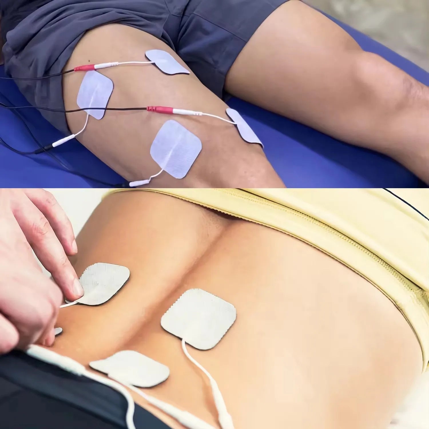 ELECTRIC MUSCLE STIMULATORS